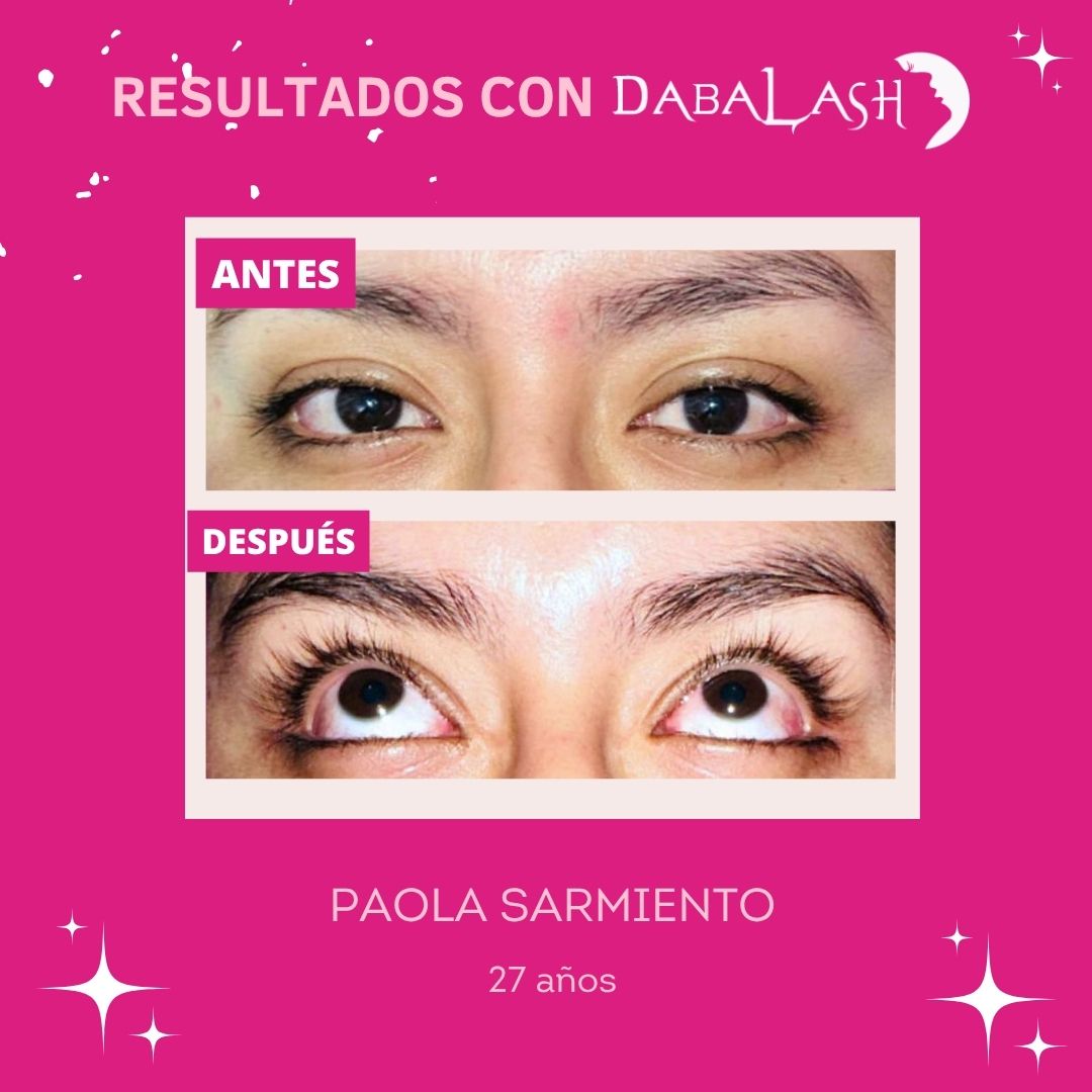 Testimonios de crecimiento de pesta&ntilde;as 